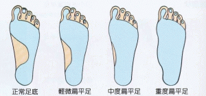 flatfoot top